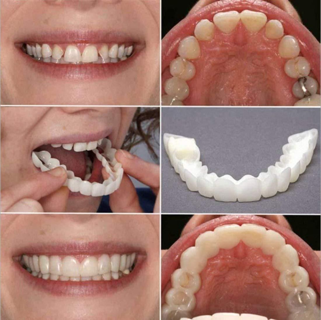 Instant and Confident on Smile Fit Flex Cosmetic Teeth Denture Teeth - Pick Baye