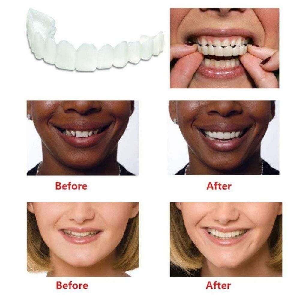 Instant and Confident on Smile Fit Flex Cosmetic Teeth Denture Teeth - Pick Baye