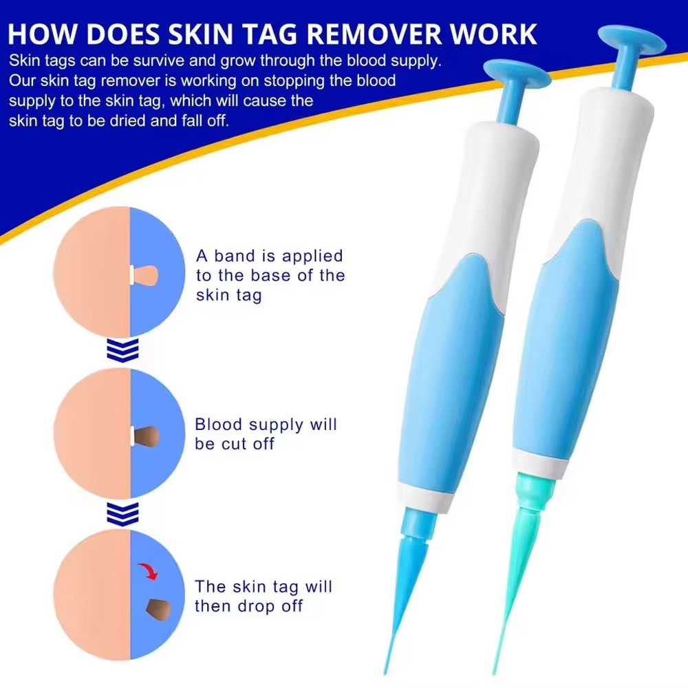 2 in 1 Skin Tag Remover Kit - Pick Baye