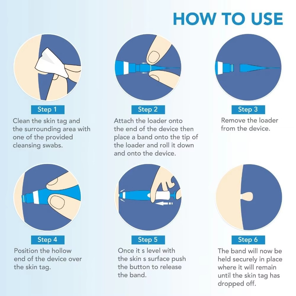 2 in 1 Skin Tag Remover Kit - Pick Baye